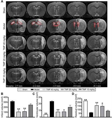 Magnetic Resonance Imaging Investigation of Neuroplasticity After Ischemic Stroke in Tetramethylpyrazine-Treated Rats